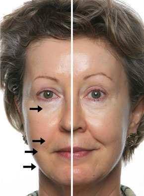 Galvanic Spa system II.